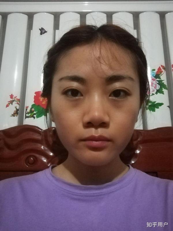 鼻子大是怎样一种体验?