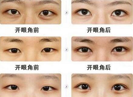 小眼睛的女生会羡慕大眼睛女生吗?