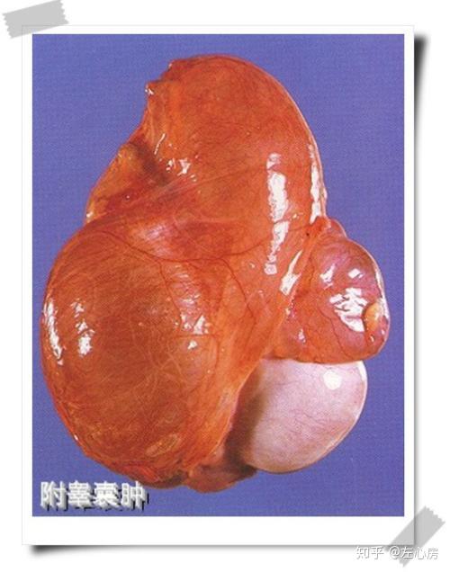 为什么两个睾丸一大一小呢? - 知乎