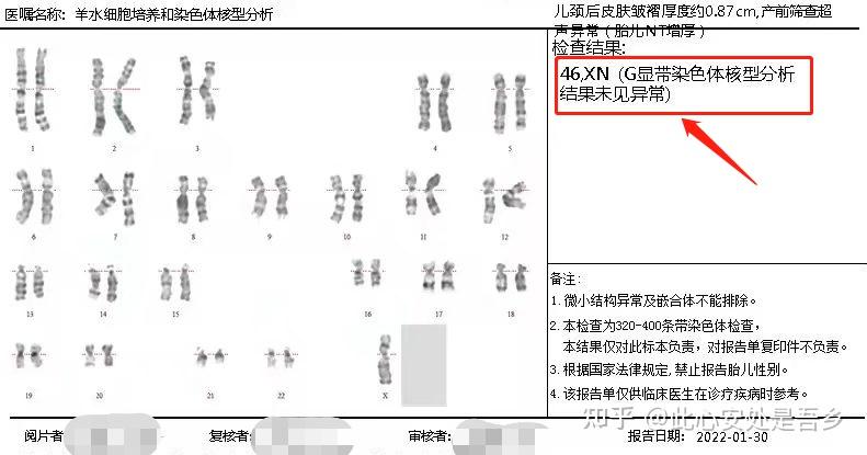 Nt增厚的宝宝到底能不能要——记录nt异常宝宝出生前的心路历程 知乎