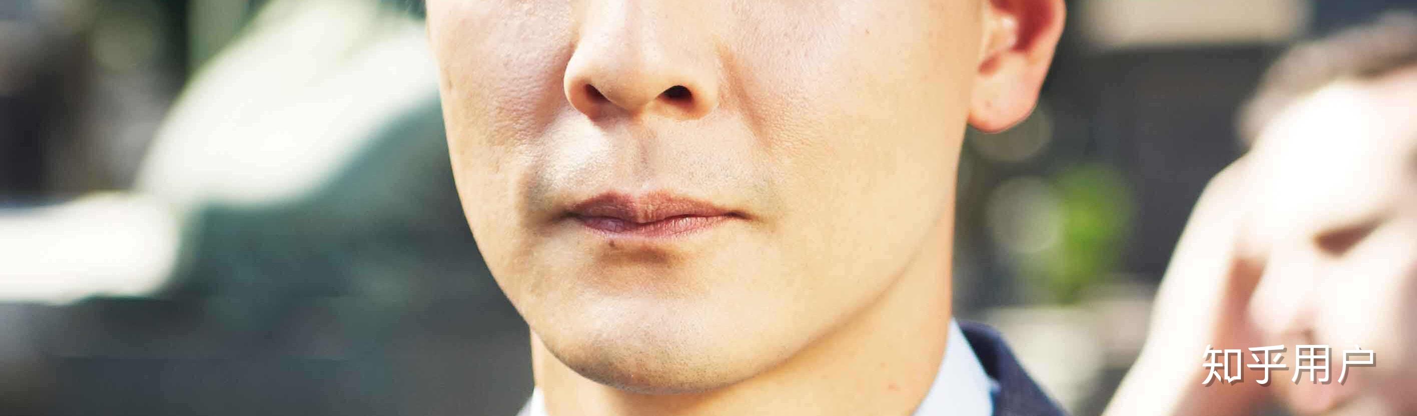 笑起来嘴角会有两道纹但不是法令纹有的人也会有但一直不知道叫什么