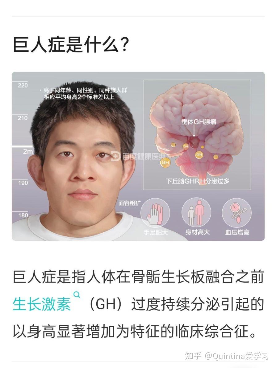 巨人症身高一般多少图片