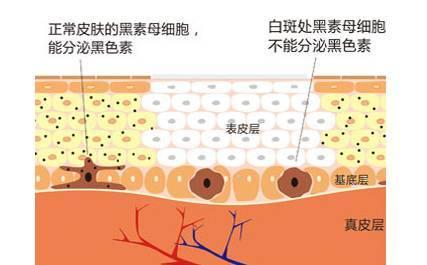 v2-81daeb892876ff4e0c6de3894dcc8b4c_r.jpg