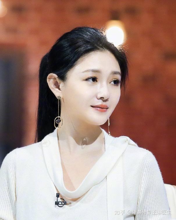 46岁大s的鼻子为什么很显年轻? - 知乎