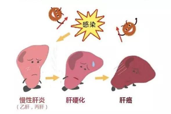 乙肝携带者病情发展的不确定性你有了解多少