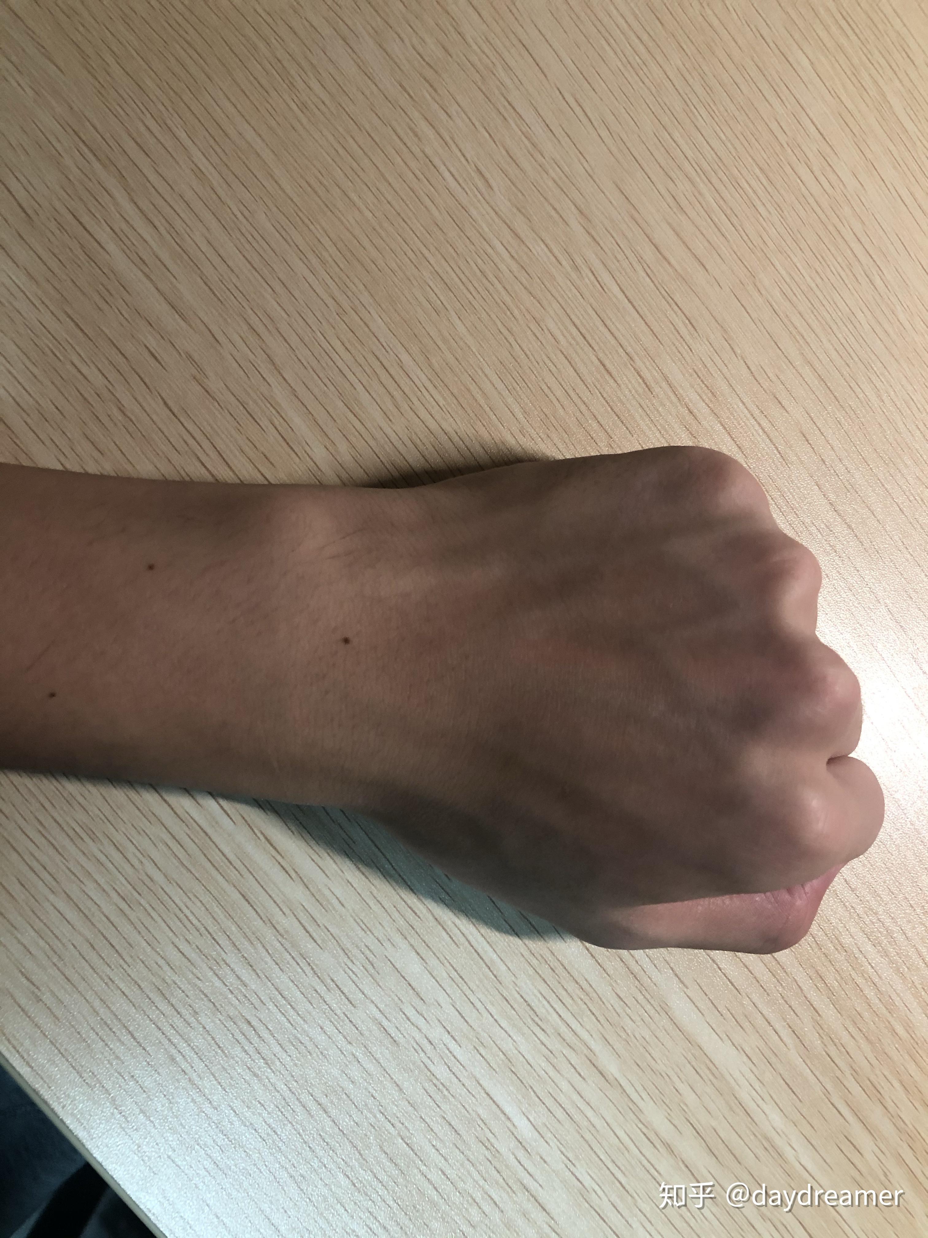 男生手腕太细14cm准备买apple watch se,应该如何选择表带? - 知乎