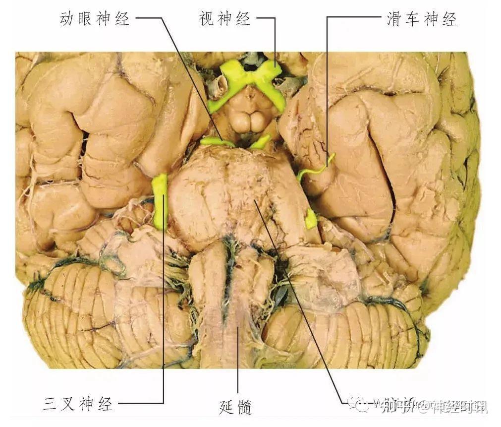 圖10.8 腦幹背側面觀(切除小腦),顯示滑車神經的出腦部位.圖10.