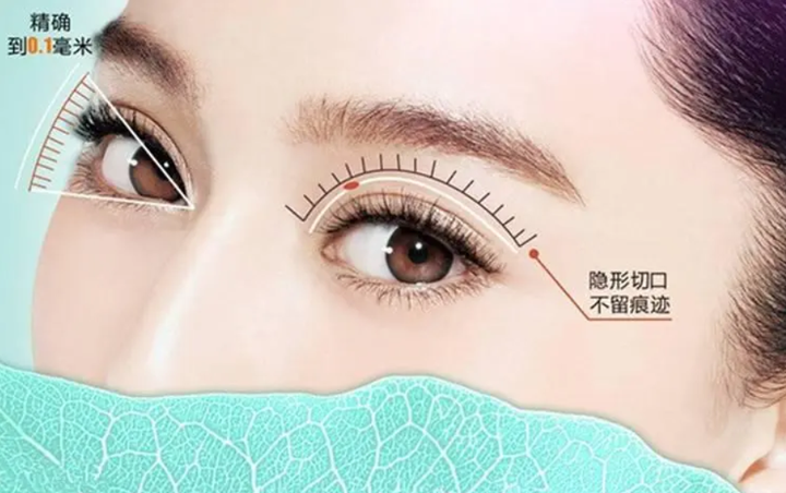 烟台曙光金琳琳眼周抗衰关注:眼周老化不容忽视 - 知乎