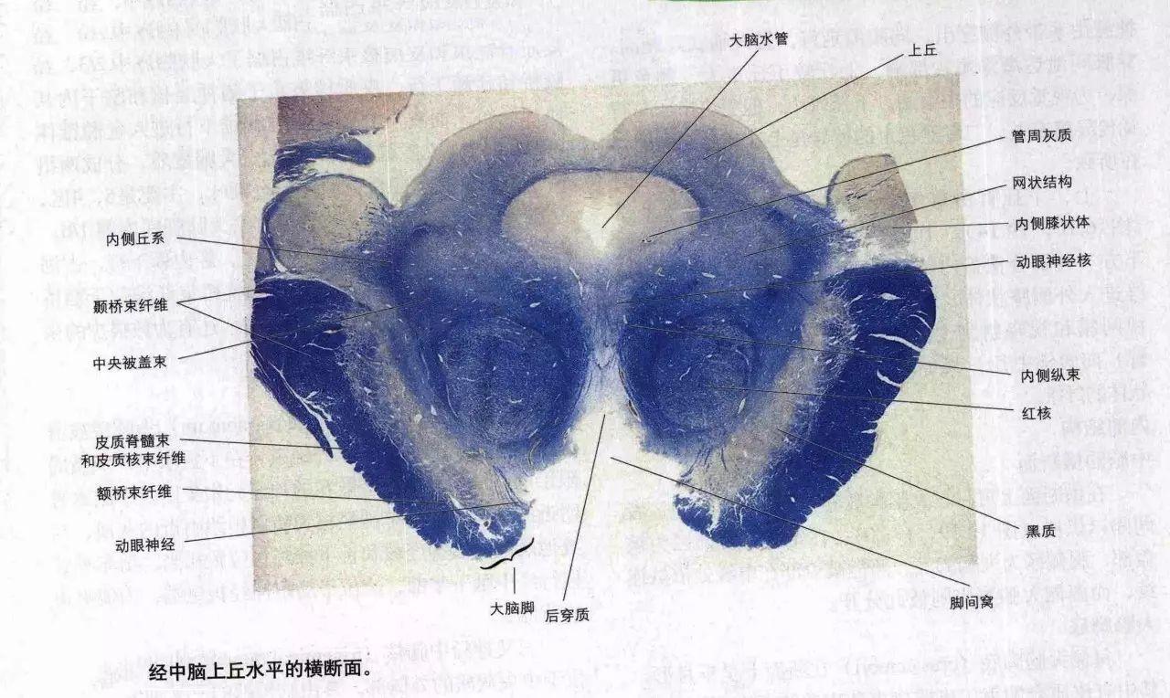 脑干切面观 - 知乎