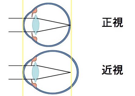 什么治人口_常住人口登记卡是什么(2)