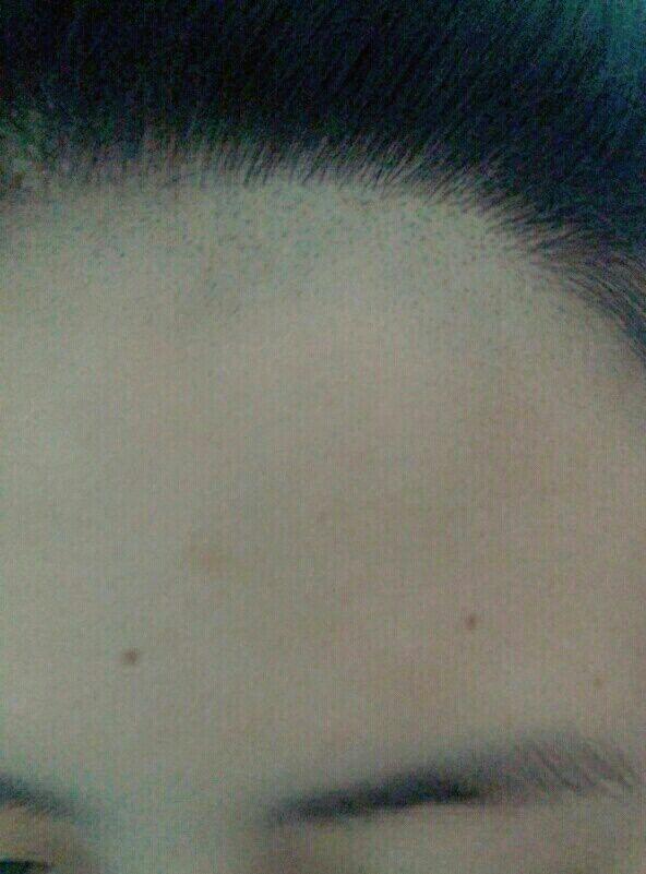 发际线太低,想自己往上刮一点,再用遮瑕粉一类