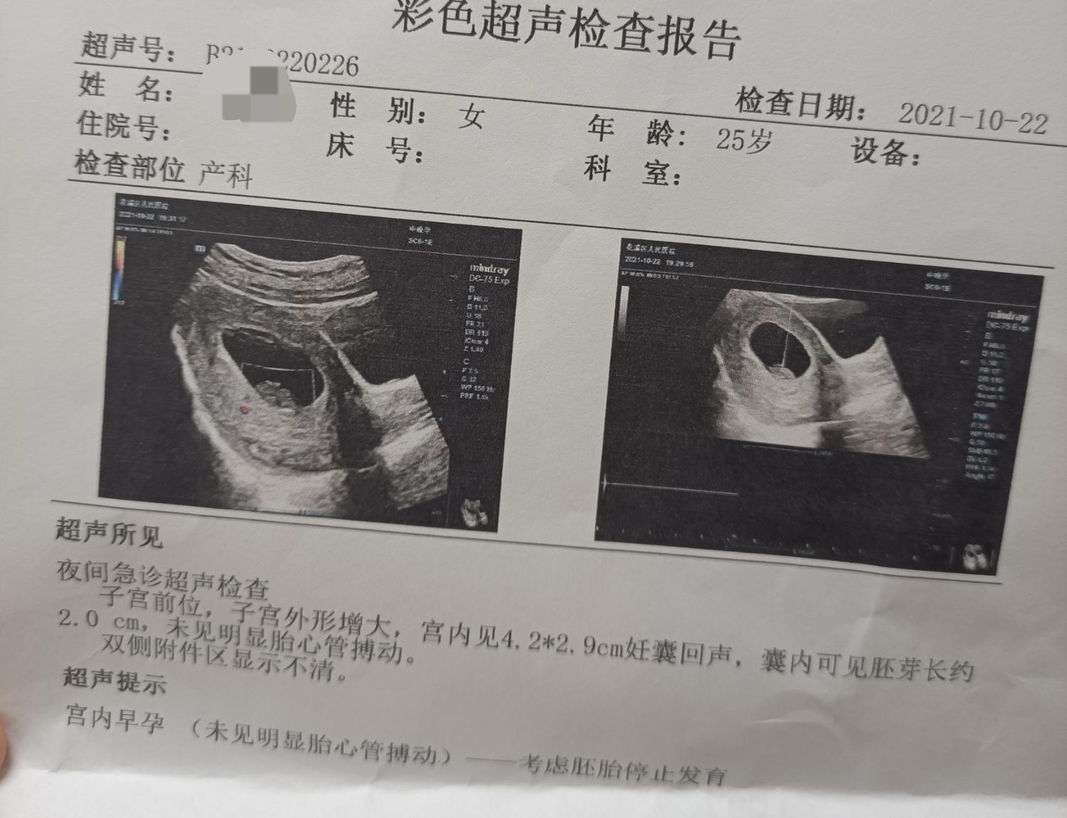 孕九周孕囊偏右侧近宫角最薄处39mm这种情况-好孕妈妈圈-好孕帮