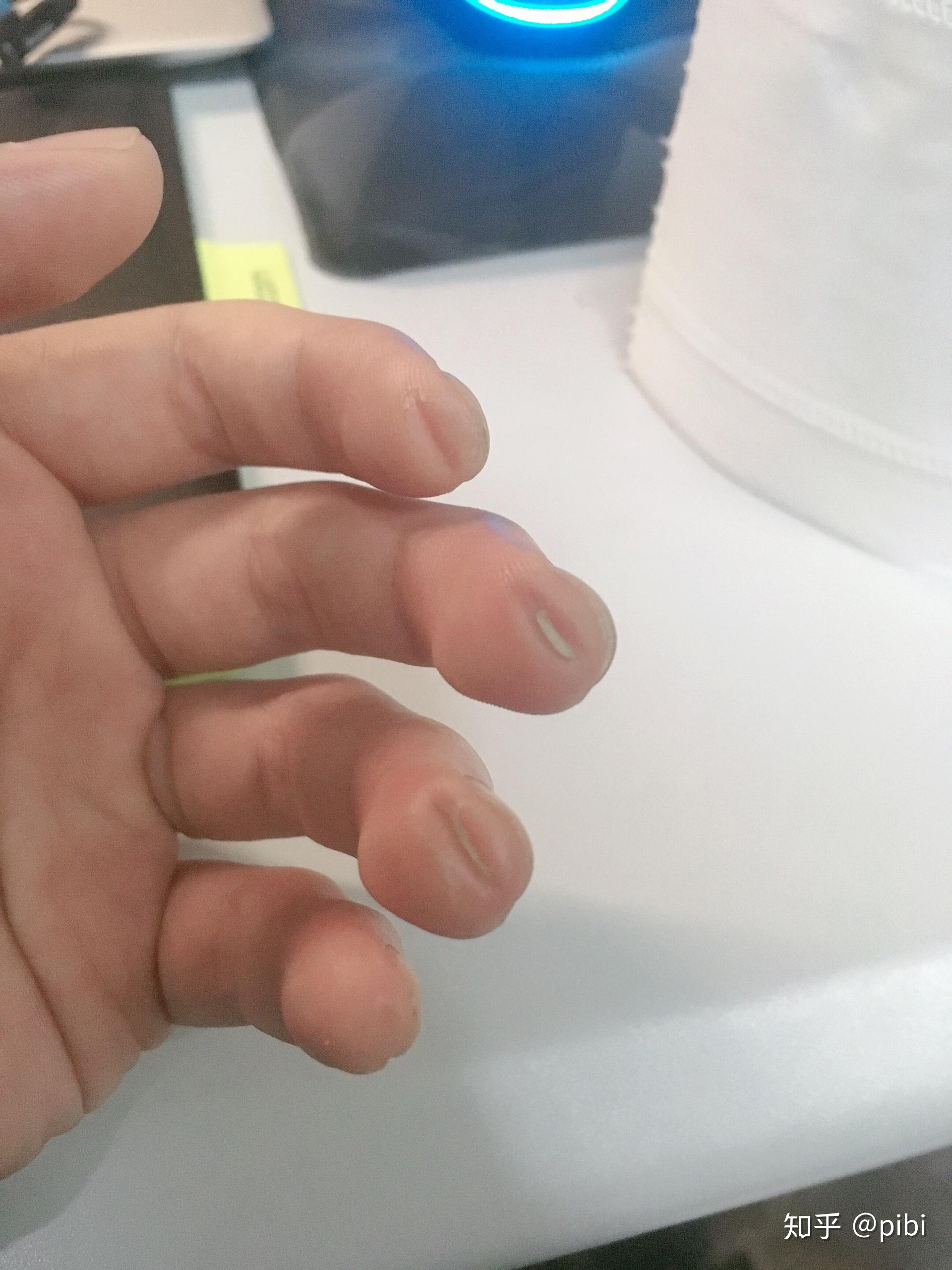 大家弹吉他的手指都是什么样的