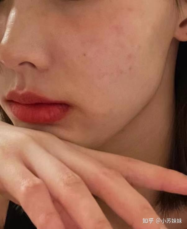 女生经常熬夜气色差该怎么补救