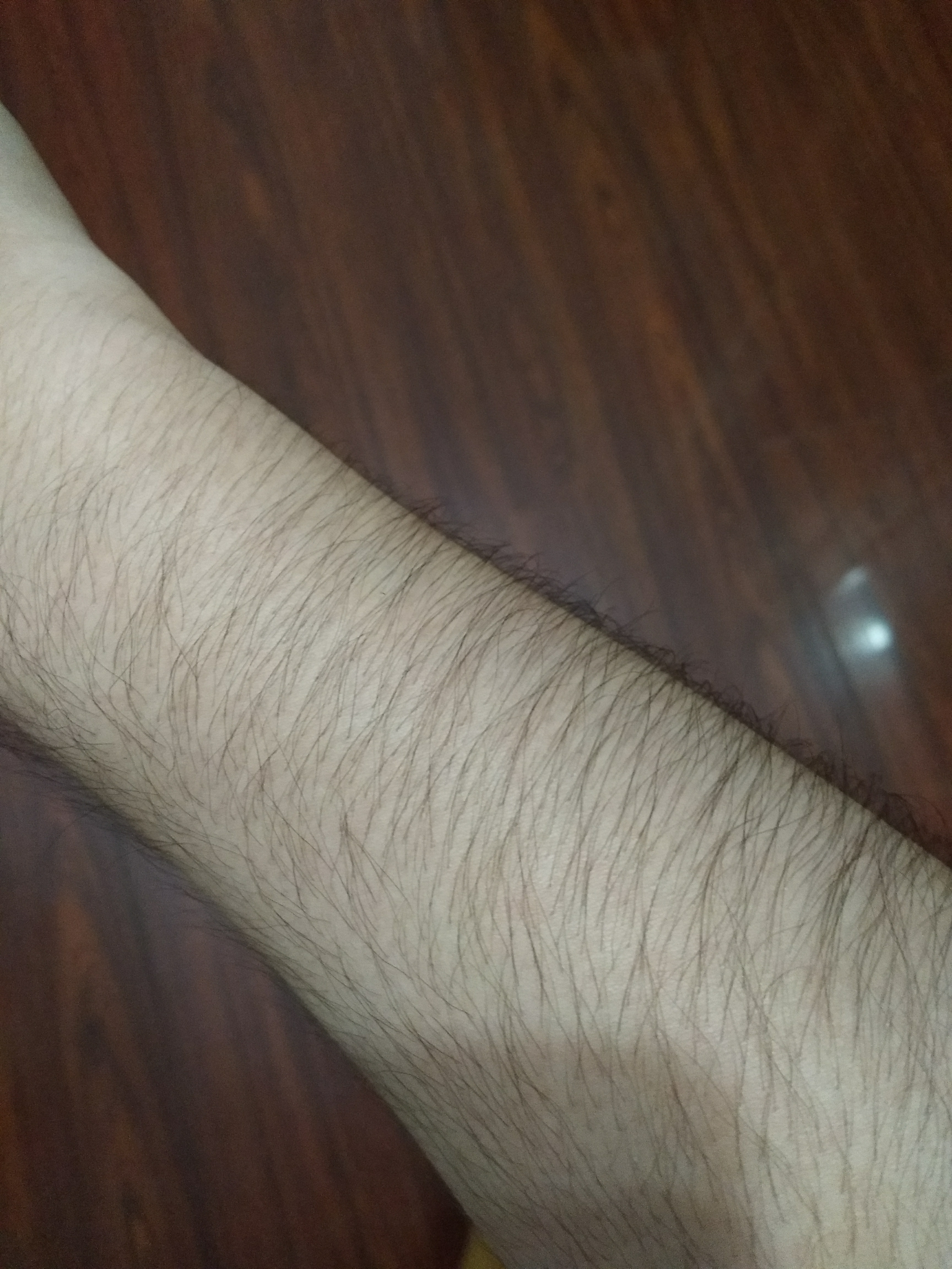 女生汗毛重是怎样的一种体验