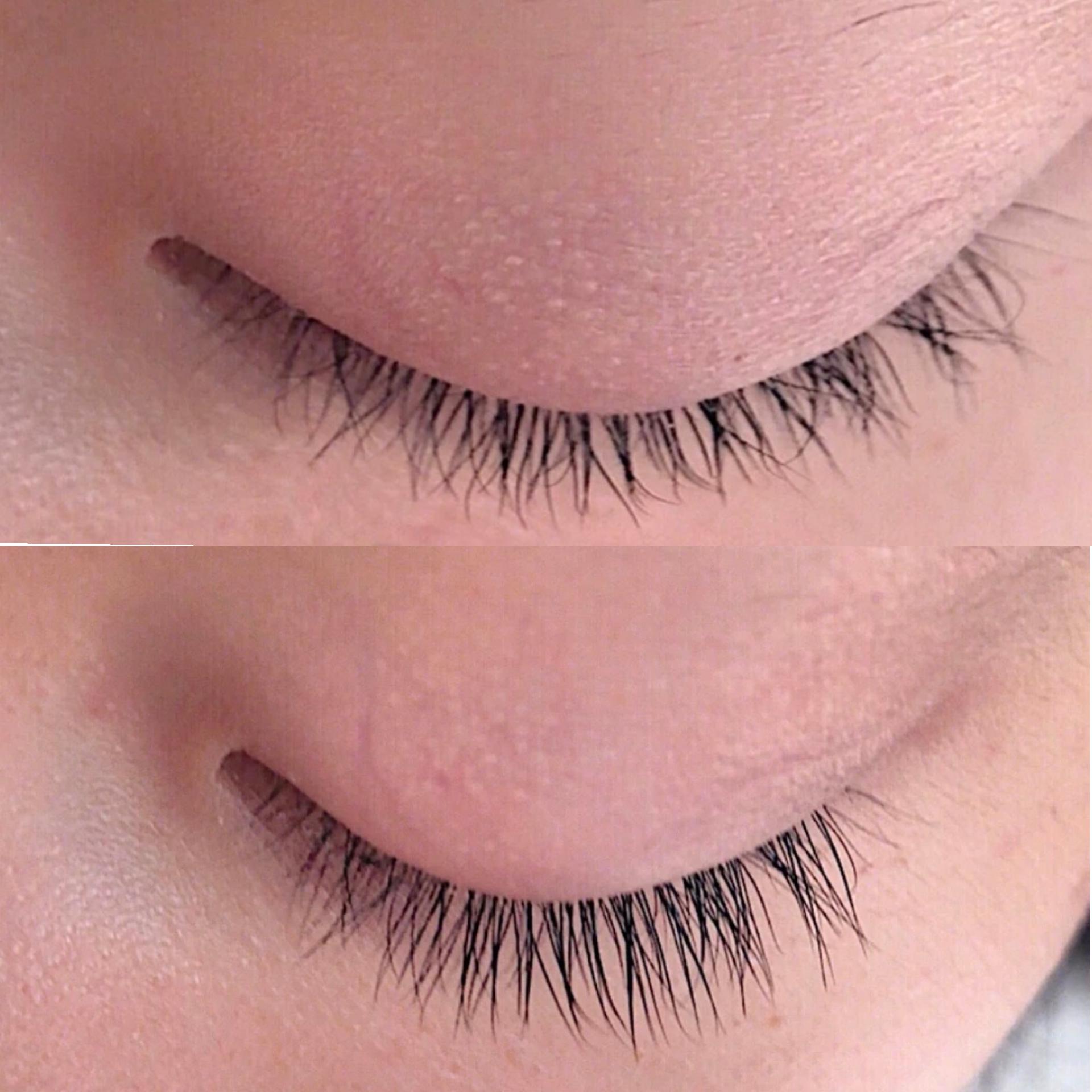 请问睫毛很长但是稀疏怎么办?有什么办法能让它密一点.