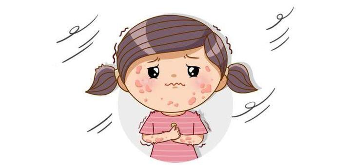 春季过敏高发季,荨麻疹悄悄到来,别着急,坚持缓解三法则