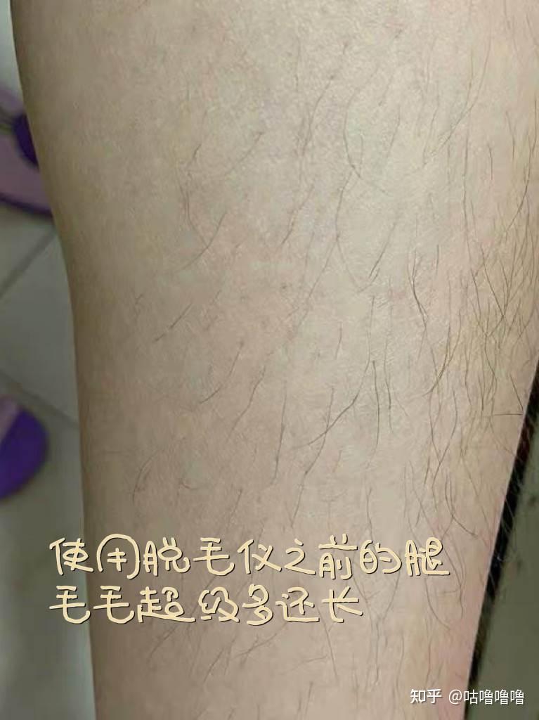 第一次使用的时候,要先用脱毛刀将长出来的汗毛刮掉后,再使用脱毛仪