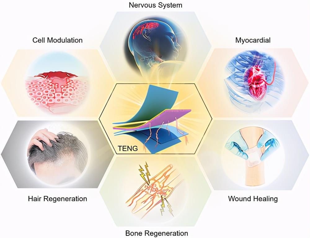 afm综述ucla陈俊自供电再生医学摩擦纳米发电机研究进展
