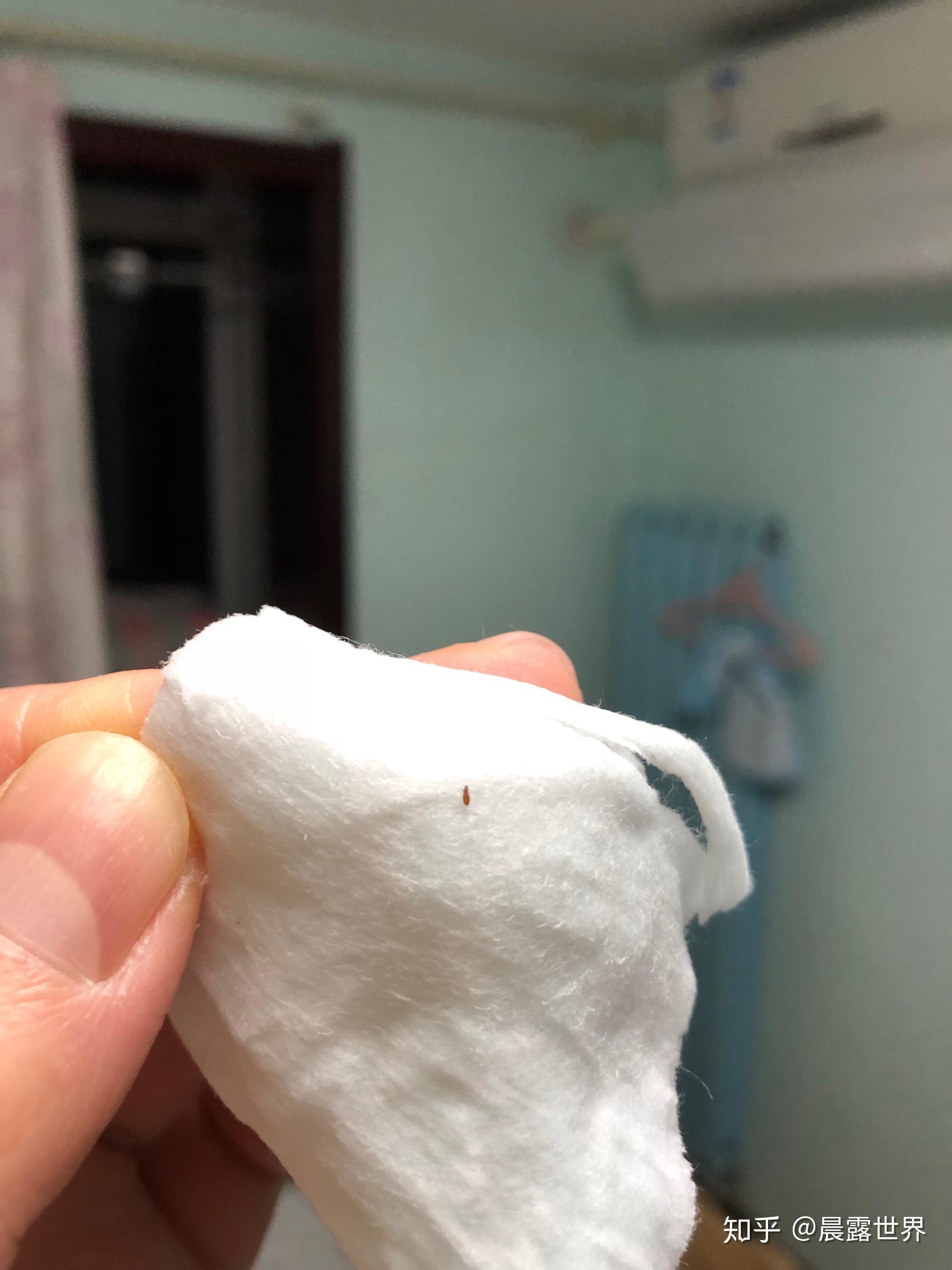 床垫和床上有很多小虫子,求助啊!有没有人知道这是什么虫啊?怎么处理?