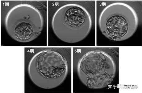 4bb囊胚图片图片