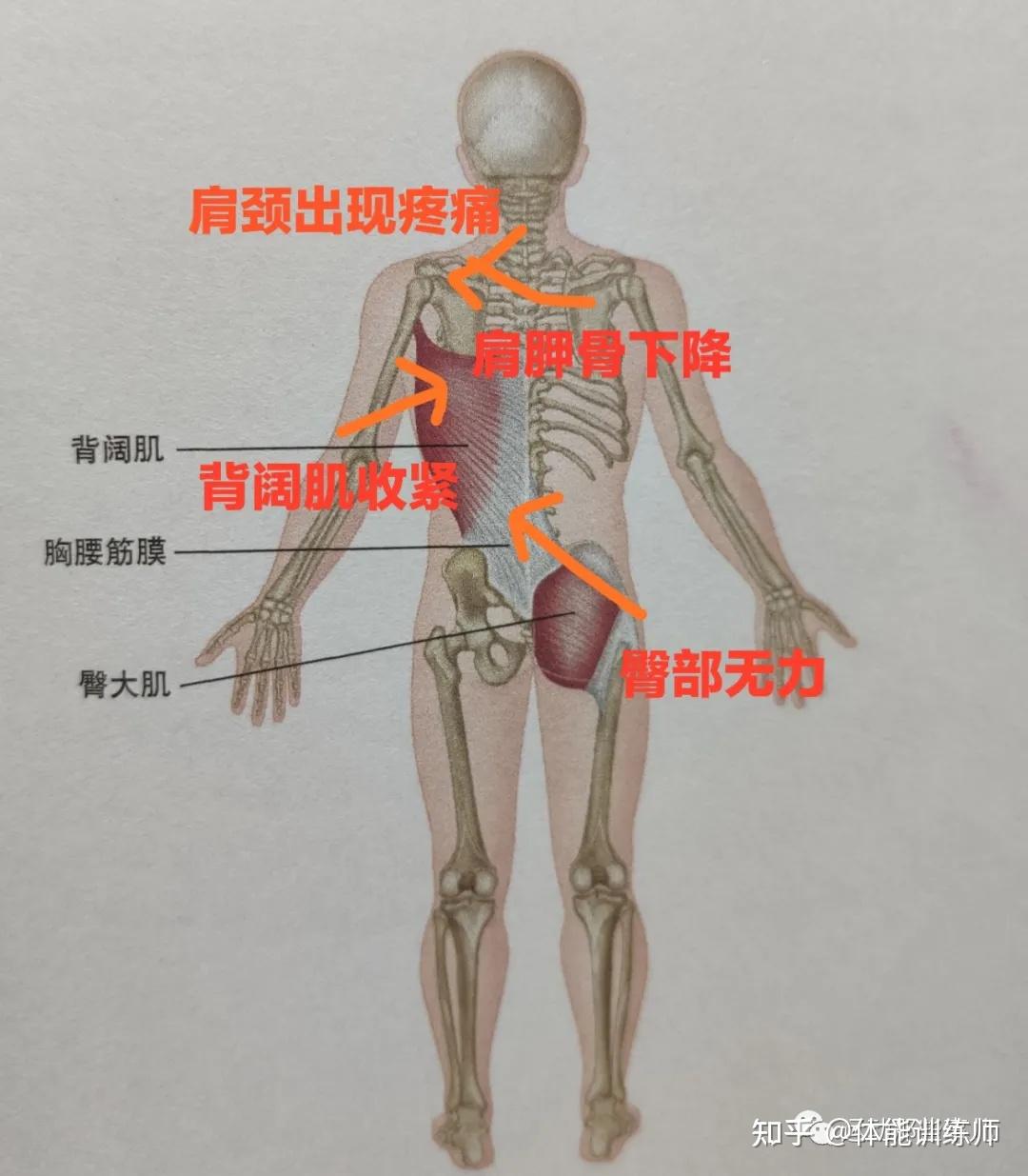 背阔肌疼痛怎么办图片