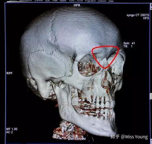 人口三角标_倒三角车标(2)