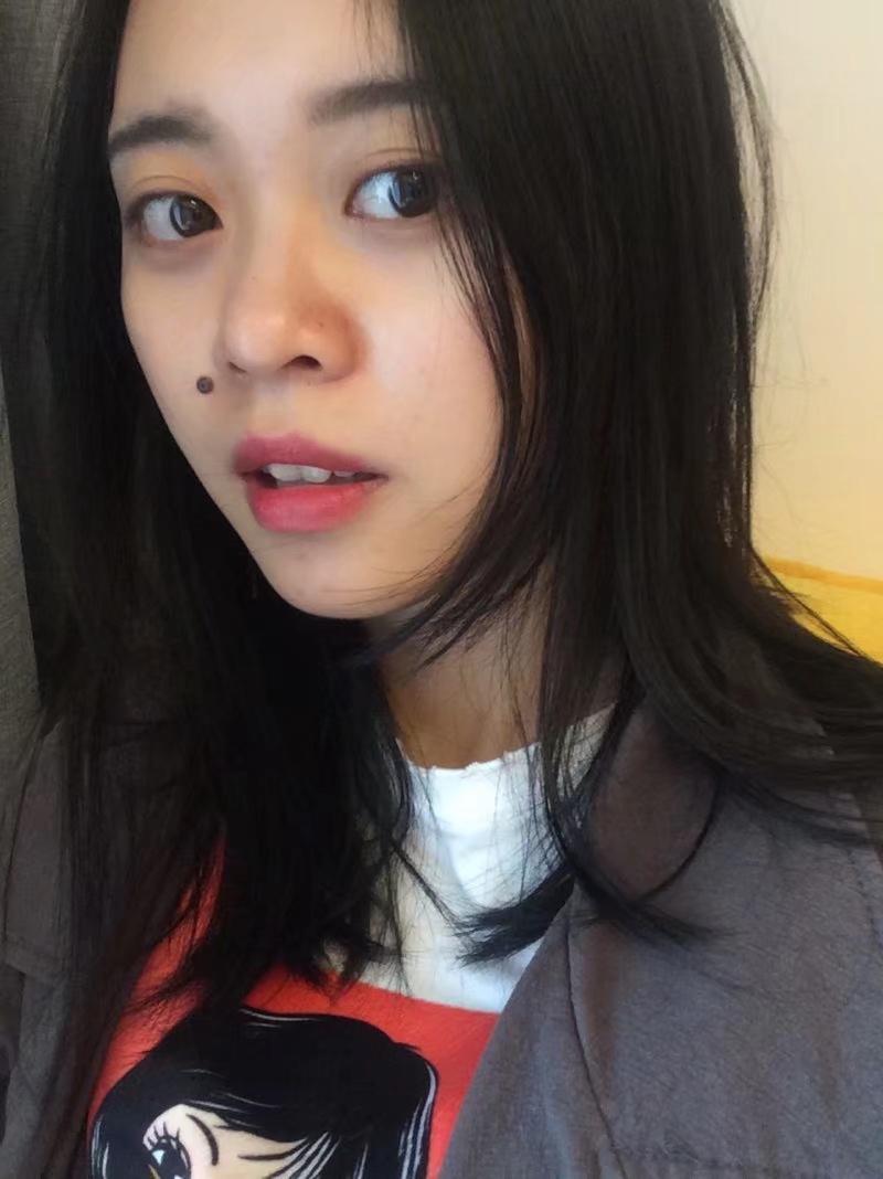 手术切痣是一种怎样的体验?