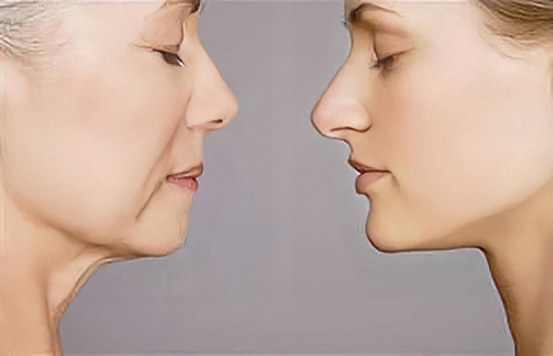 面颊凹陷怎么办？脸颊凹陷的原因是什么呢？这真是人类_圈子-新氧美容整形