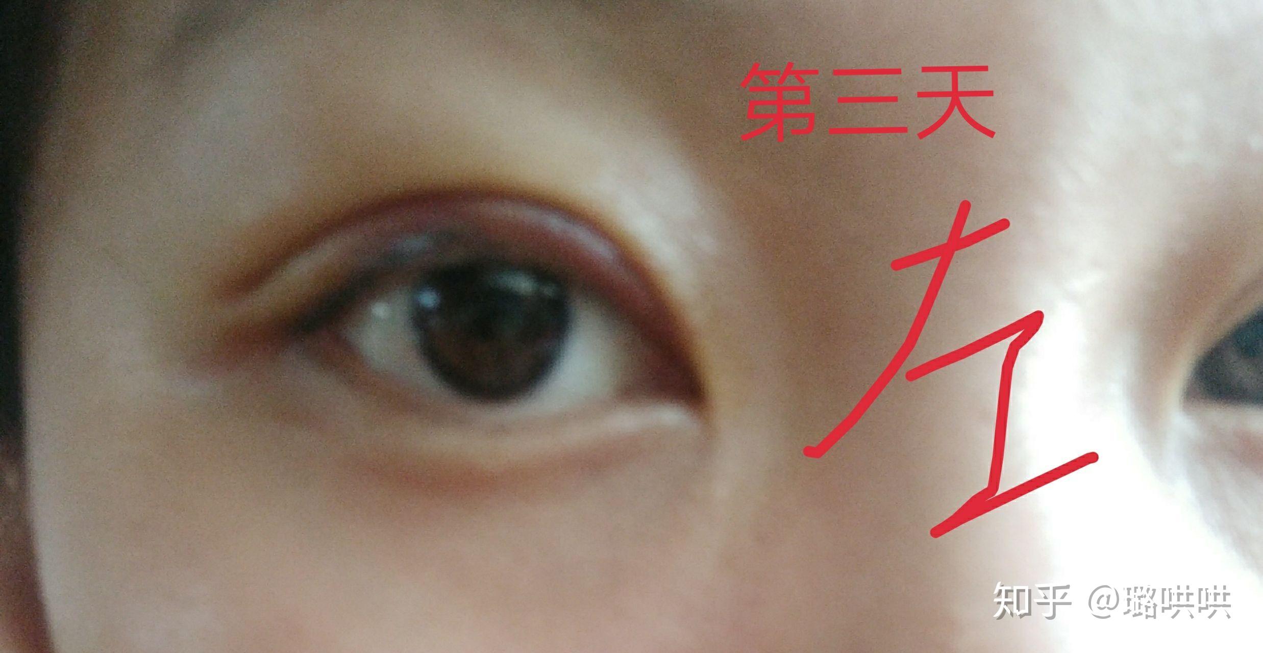 v2-83c3265f80ee79f09dd3a9e9079dfba0_r.jpg