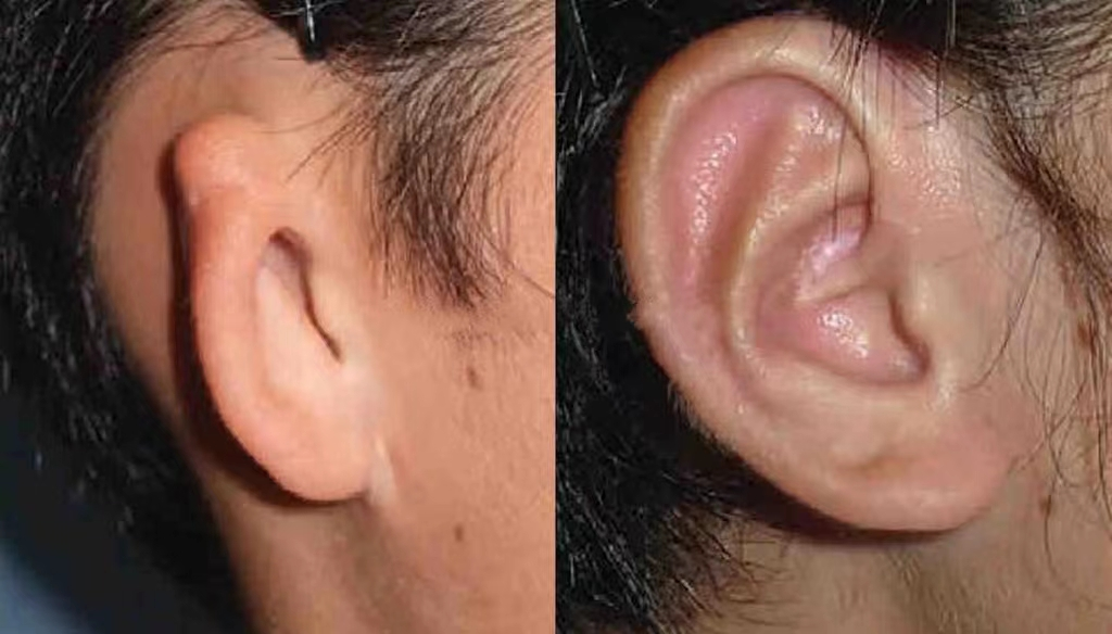 耳再造国内有哪些医生做得好有没有一二线城市的专家案例