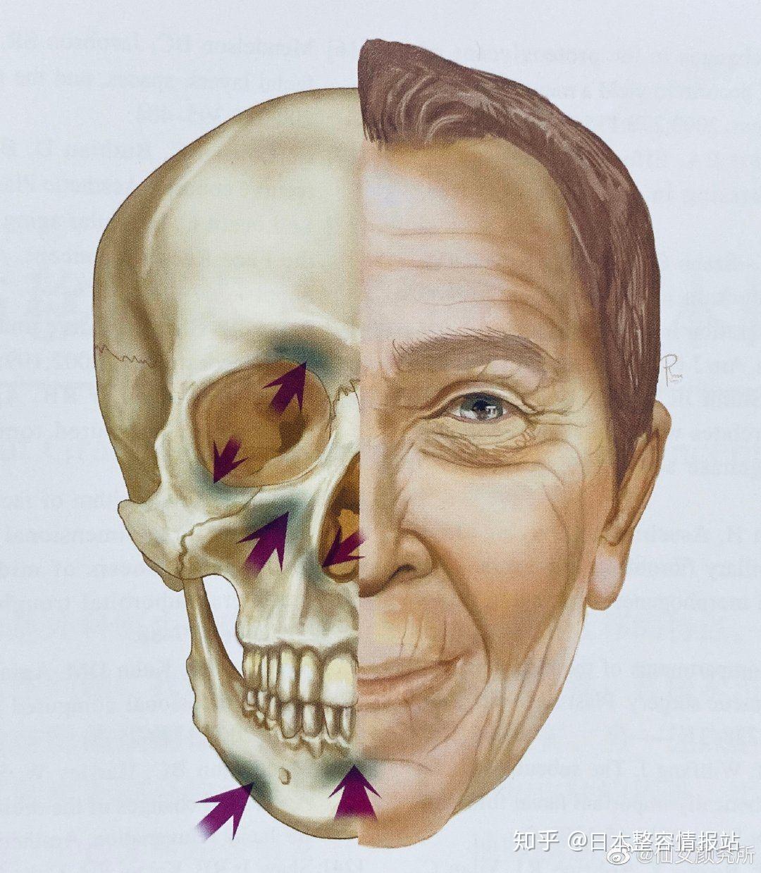国内有四级磨骨资质的医院是哪些？下颌角、颧骨、正颌技术经验深的医生建议？费用4万-20万有哪些医生选择？ - 知乎