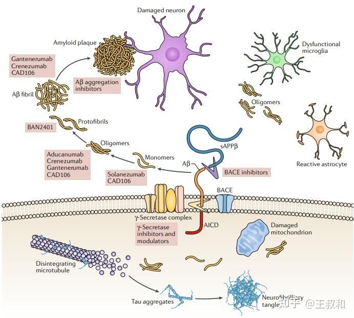 神经退行性疾病图片