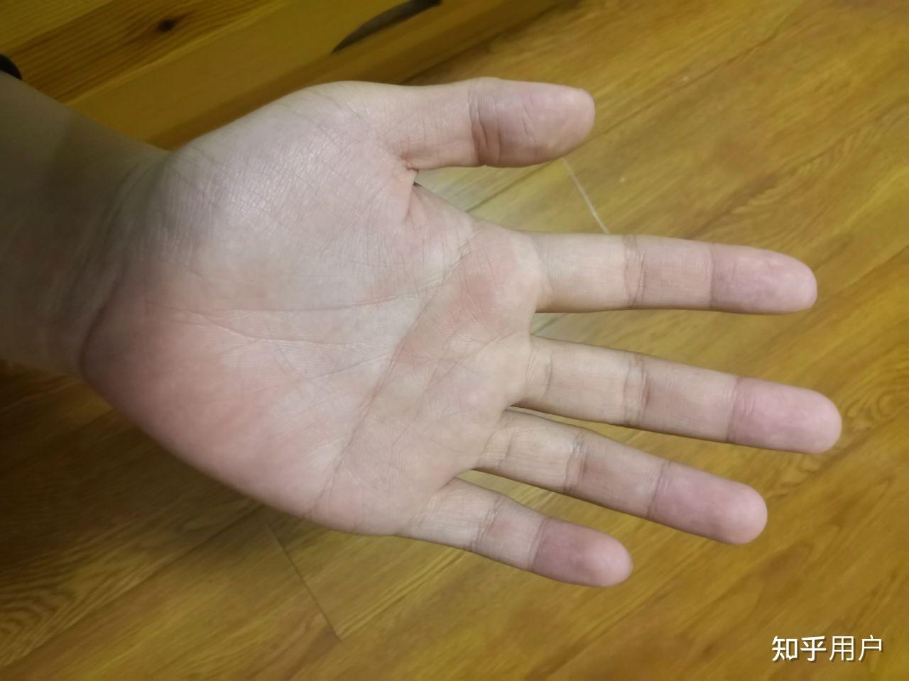 被打手心是种怎样的体验? - 知乎