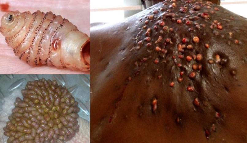 有哪些逼死密集恐惧症的图片或视频? - 知乎