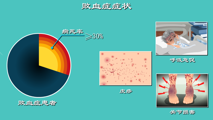 全球年患病人数超过1900万,病死率超30%,解密“死神的镰刀”败血症 - 知乎