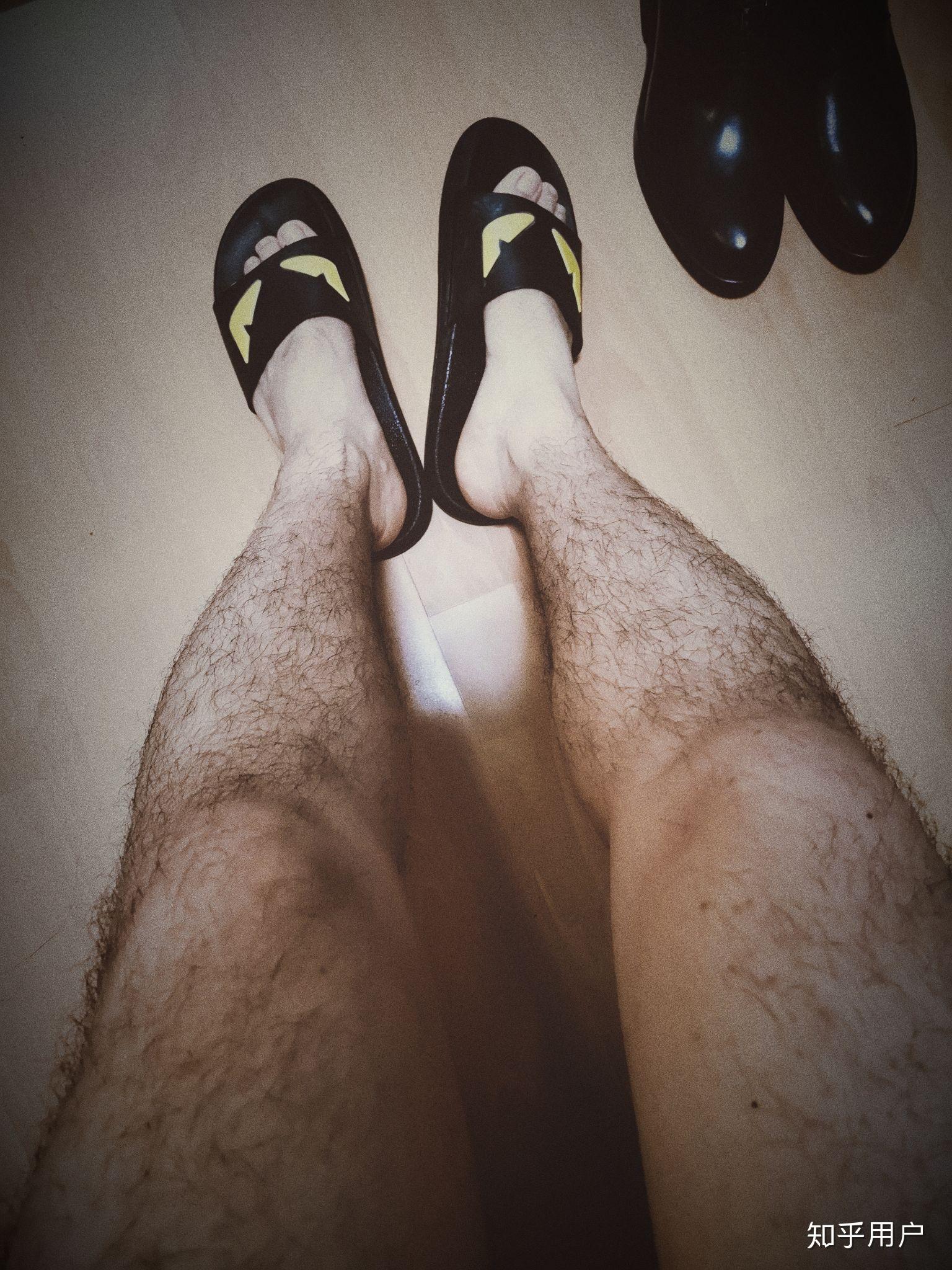 腿毛多的男生夏天怎么办?