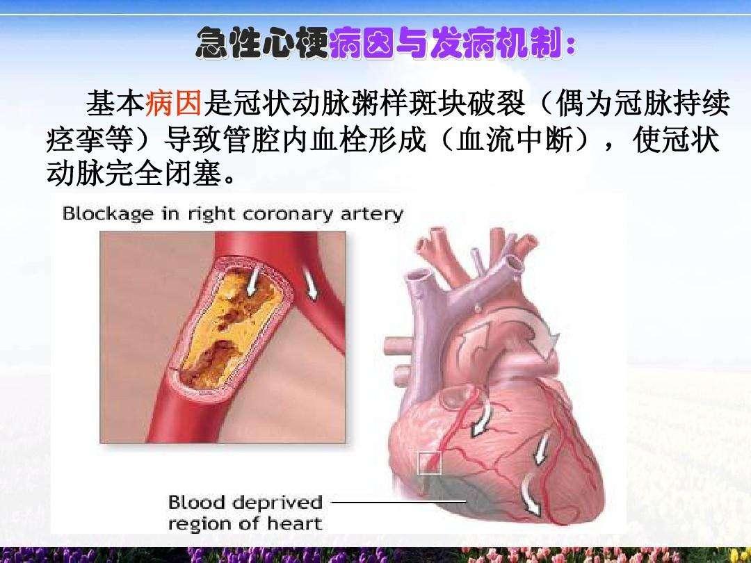 我妈说脑梗,心梗比脑出血还厉害,一般就是一下子就过去的事儿,几分佑