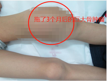手腕疼痛警惕四种病 v2-84b9f18036898d7a0d69a81809eb058e_1440w.jpg?source=172ae18b