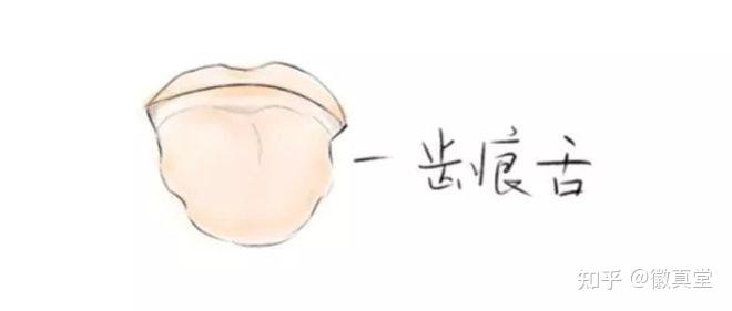 最全舌诊图解!教你6大方法,看舌头懂健康,收藏备用! - 知乎