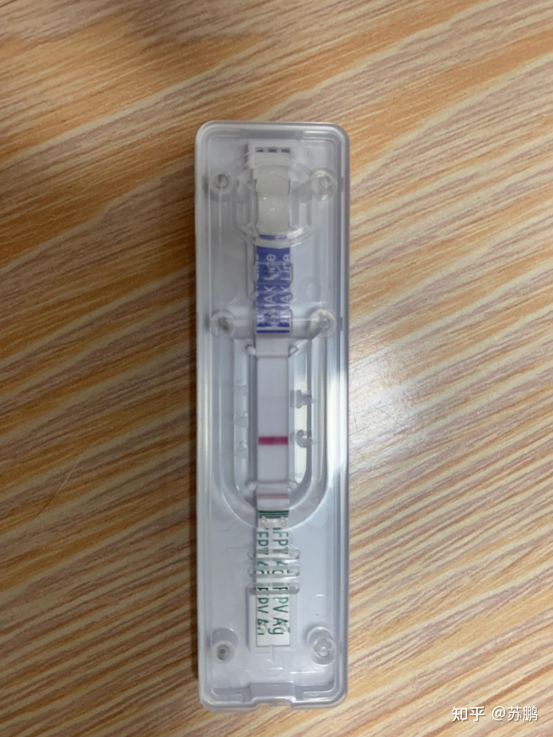 猫瘟的误诊和急性肠胃感染分享一个病例给铲屎官