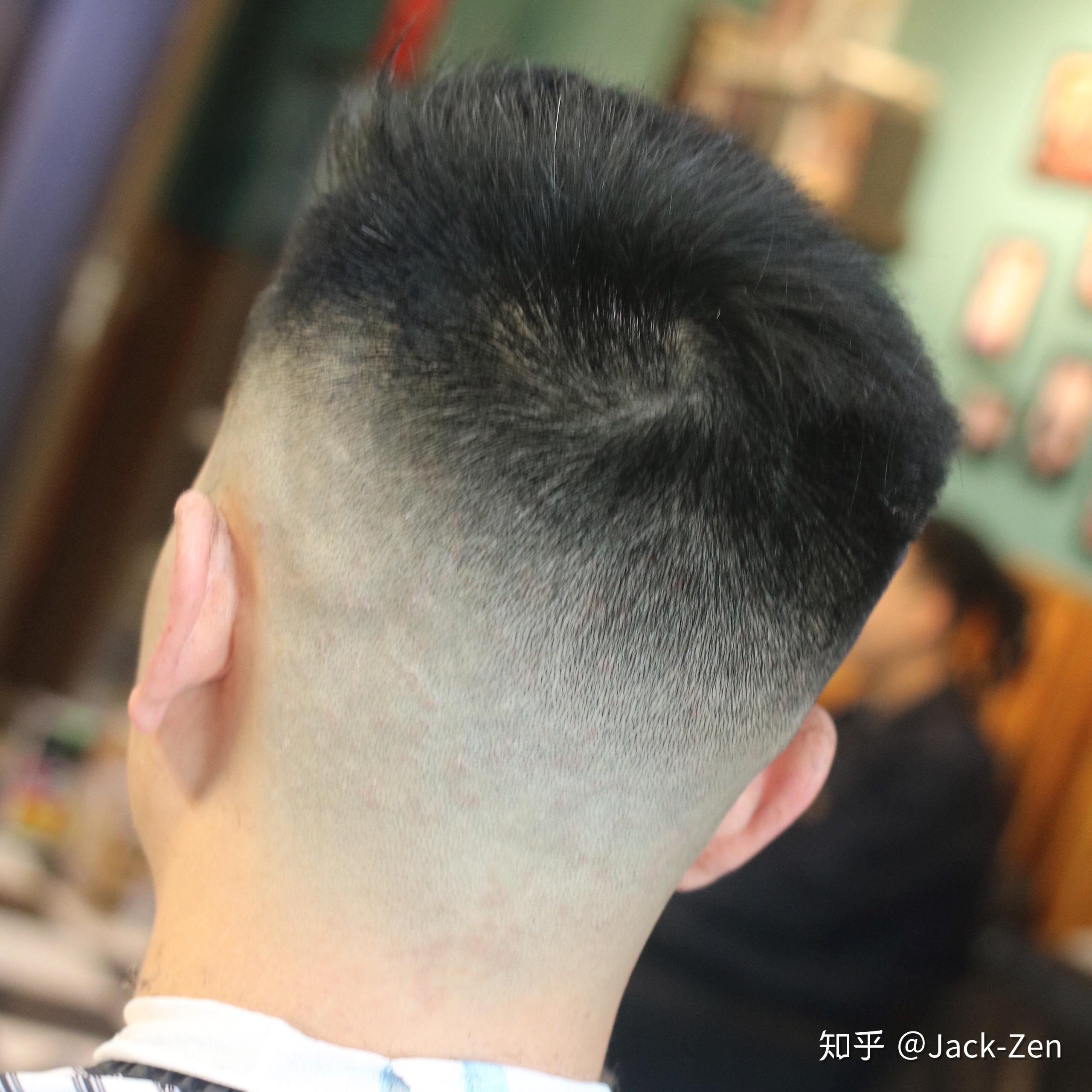 后脑勺太高留什么样的发型啊