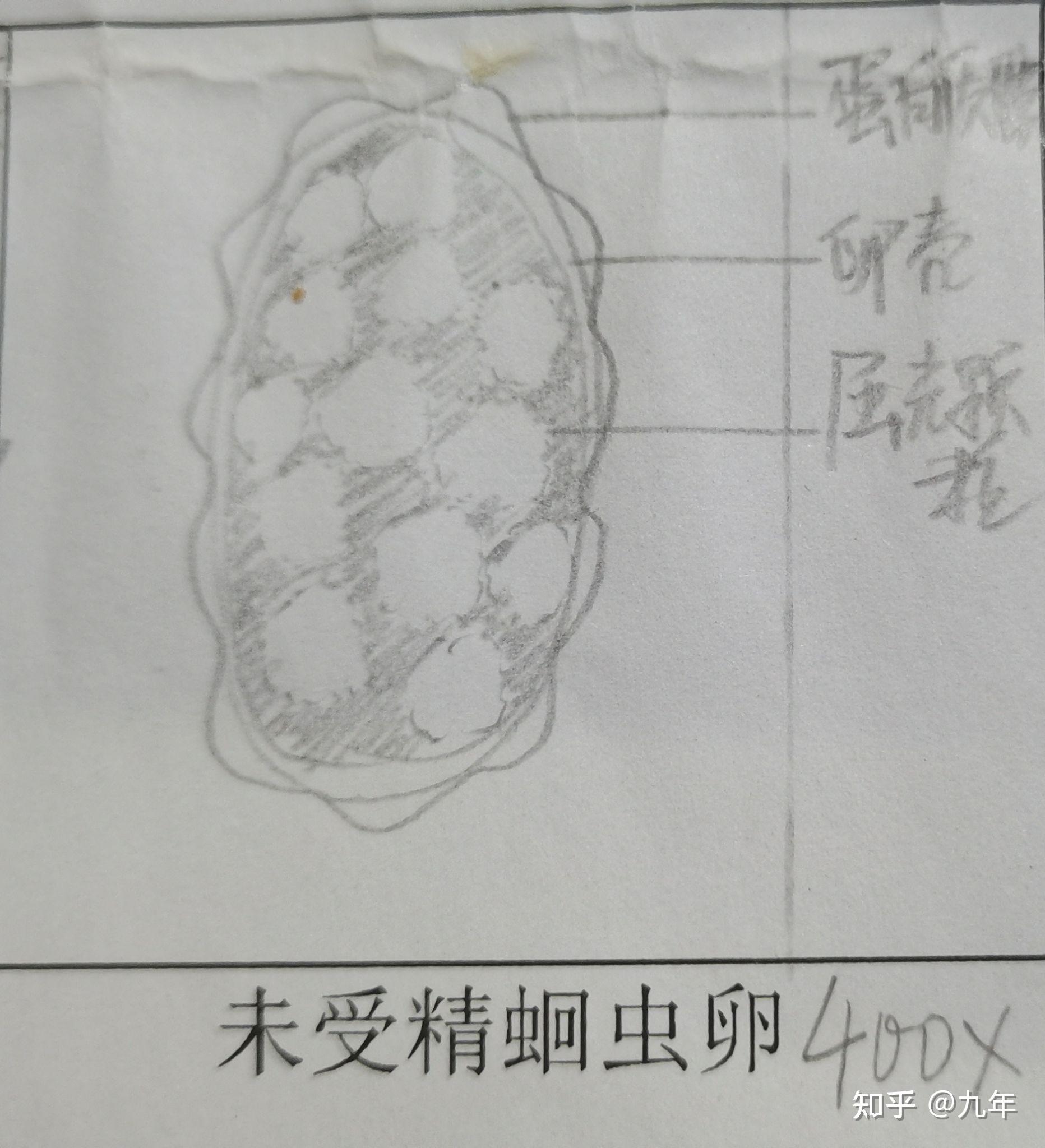 姜片虫卵绘图图片
