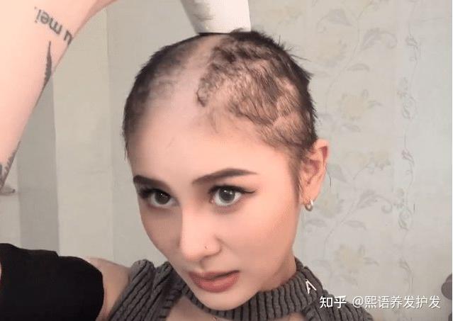 剃光头真的可以让头发越来越多越来越密码？ - 知乎