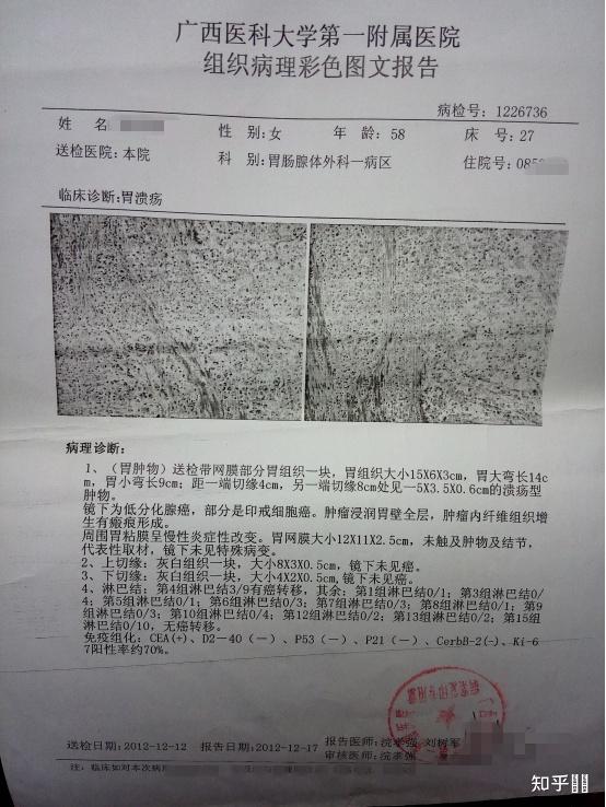 有没有胃癌中晚期活过10年的积极例子? - 知乎