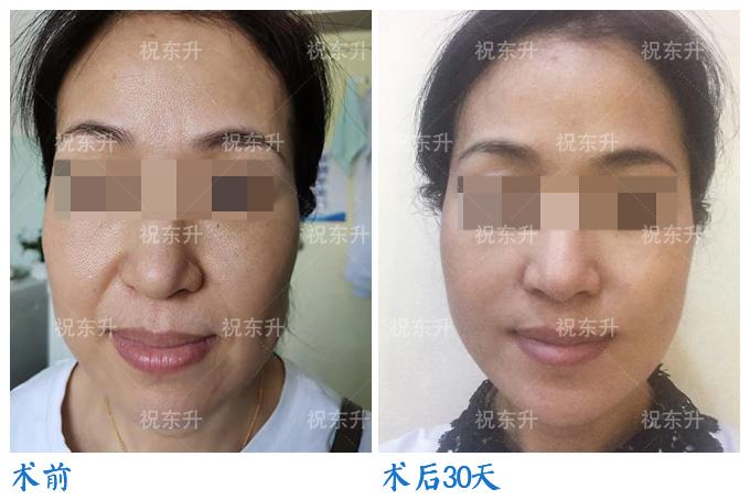 北京整形排名_北京京韩整形(3)