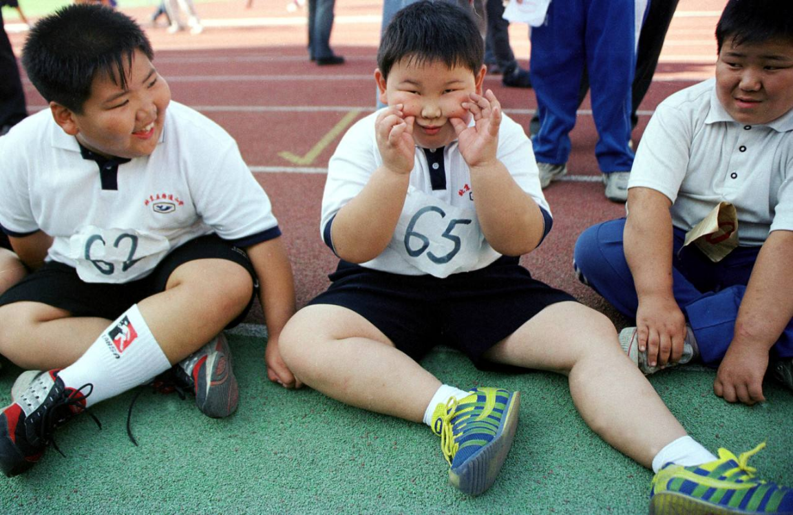 青少年肥胖,能做胃转流手术吗?