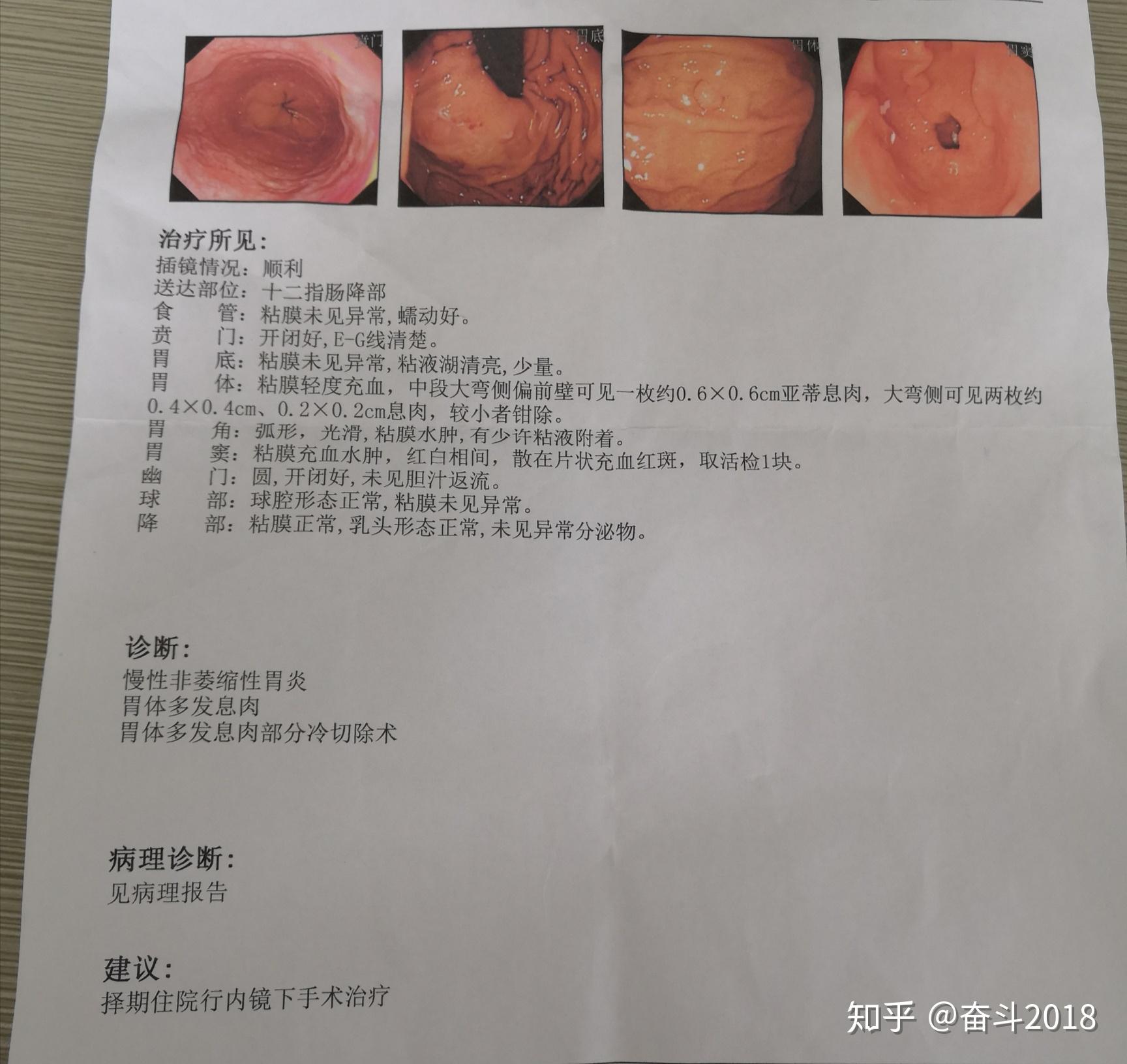 我在北京中日友好医院看胃病的经历！（2022年） - 知乎
