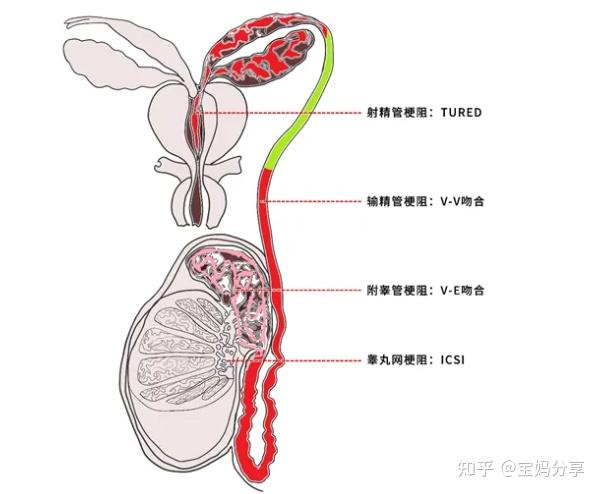 过小,男性假两性畸形,尿道上裂或下裂,后天性阴茎炎症或损伤,阴囊水肿