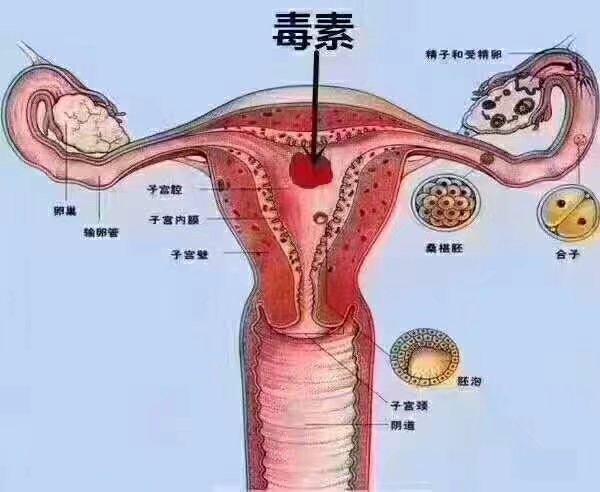 缩阴手术的副作用